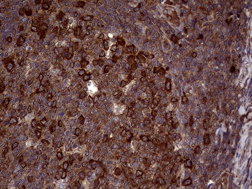RAB23 Antibody (aa1-234, clone OTI1A3, Carrier-free)