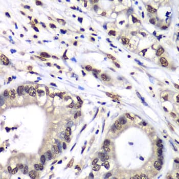 HNRPM / HNRNPM Antibody