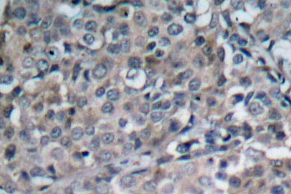 Polyclonal Rabbit anti-Human FAK / Focal Adhesion Kinase Antibody (Arg919, IHC, IF, WB)