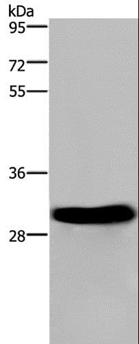 Polyclonal Rabbit anti-Human FHL2 Antibody (IHC, WB)