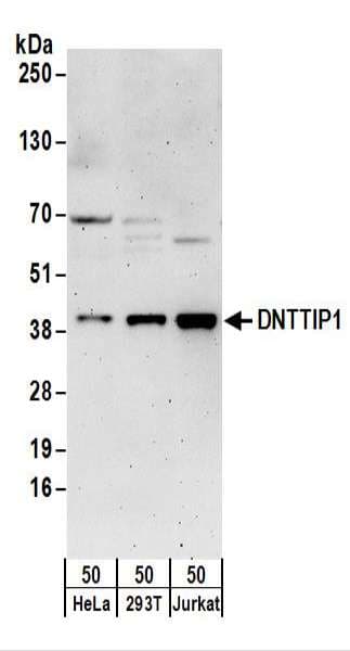 Polyclonal Rabbit anti-Human DNTTIP1 / TDIF1 Antibody (aa279-329, WB)
