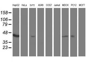 ACY1 / Aminoacylase 1 Antibody (clone OTI2D3)