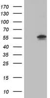 AKT1 Antibody (clone OTI3E3)