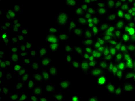 Polyclonal Rabbit anti-Human TRPS1 Antibody (IF, WB)