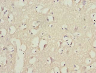 PIK3R3 / p85 Gamma Antibody