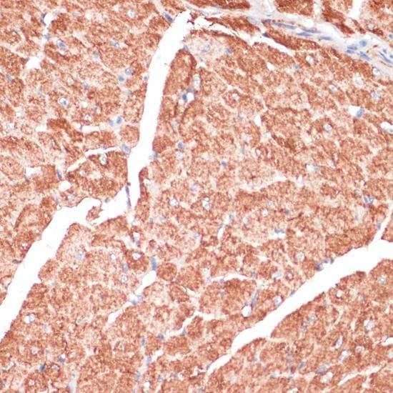 DES / Desmin Antibody