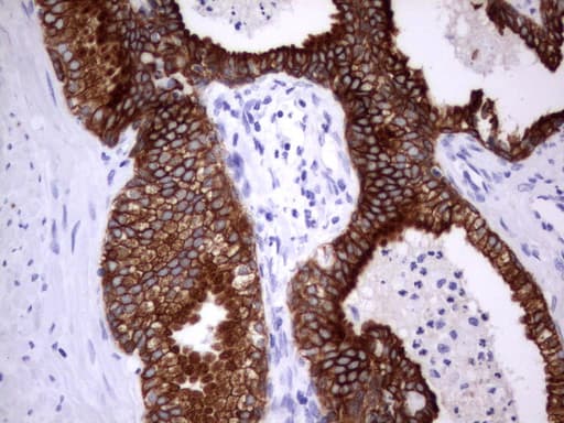Acidic Cytokeratin Antibody (clone 8F5)