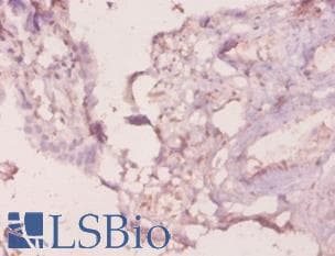 LGALS3 / Galectin 3 Antibody (FITC)