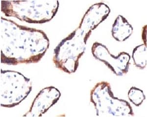 CGB / hCG Beta Antibody (clone CGB63)