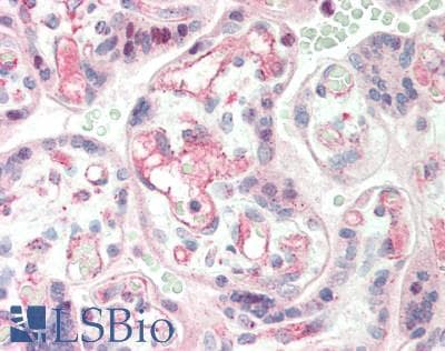 IHC-plus™ Polyclonal Rabbit anti-Human TFB1 / GTF2H1 Antibody (aa32-81, IHC, WB)