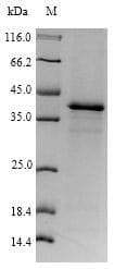 Human N6AMT1 Protein (Recombinant GST, N-terminus)