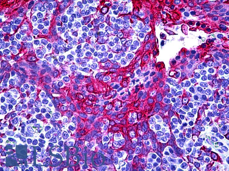 IHC-plus™ AKR1C4 / Chlordecone Reductase Antibody (clone 2C11)