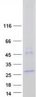 Human LHFPL2 Protein (Recombinant Myc-DDK (Flag))