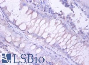 PSMB4 Antibody