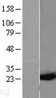 GSTP1 / GST Pi Protein (Over-Expression Lysate Myc-DDK (Flag))