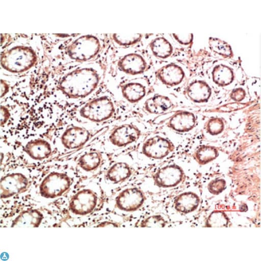 Collagen II Antibody