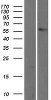 TBX5 Protein (Over-Expression Lysate Myc-DDK (Flag))