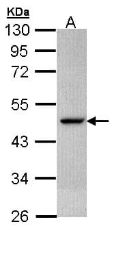 IHC-plus™ CS / Citrate Synthase Antibody (Internal)