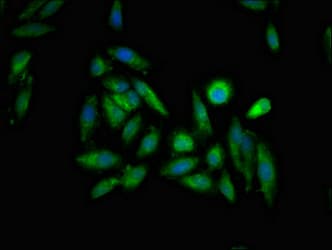 ITPR1 / IP3 Receptor Type 1 Antibody