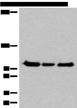 Polyclonal Rabbit anti-Human XPO1 / CRM1 Antibody (IHC, WB)