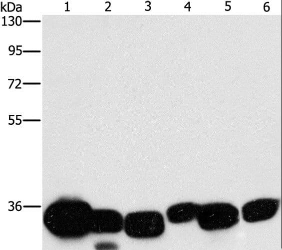 Polyclonal Rabbit anti-Human CBR / CBR1 Antibody (IHC, WB)