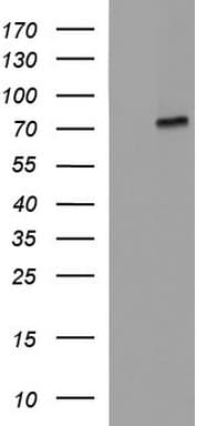 ALB / Serum Albumin Antibody (aa19-609, clone OTI3H8)
