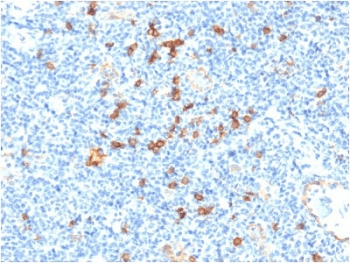 IL3RA / CD123 Antibody (clone IL3RA/1531)