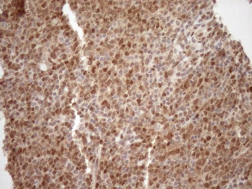 MGMT Antibody (clone OTI4F9)
