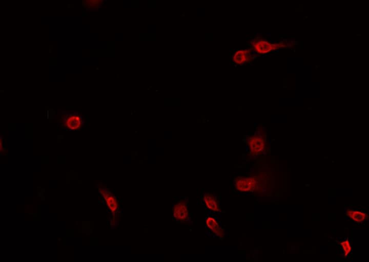 MAPK8 / JNK1 Antibody
