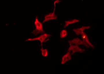 Polyclonal Rabbit anti-Human GRID2 Antibody (IF, WB)