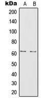 IL20RA Antibody (Internal)