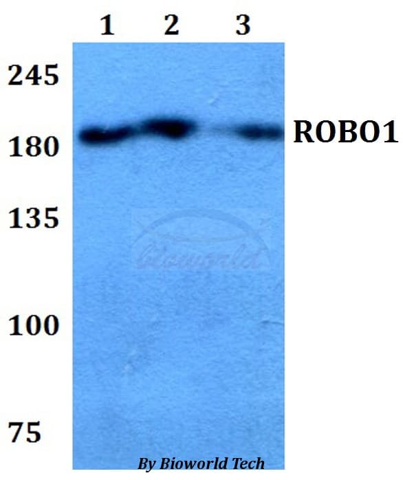 ROBO1 Antibody