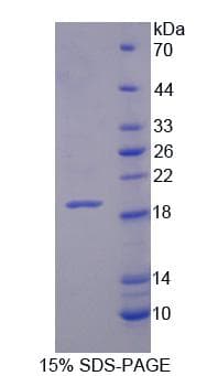 Human XYLT1 / XylT-I Protein (Recombinant His, N-Terminal)