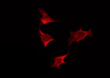 ABHD2 Antibody
