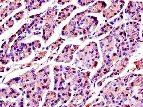 SPINK1 Antibody