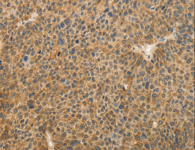 TFPI2 Antibody