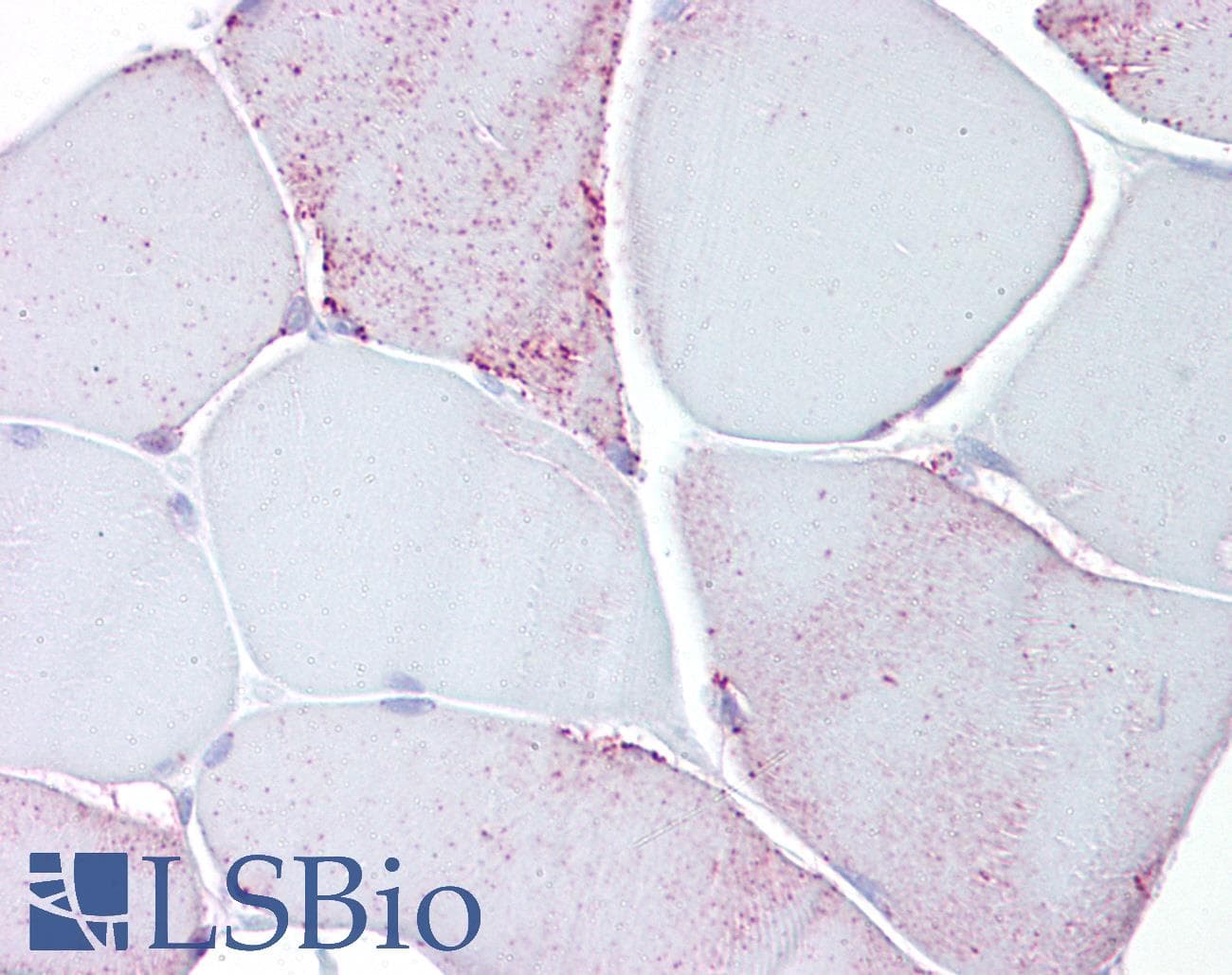 IHC-plus™ Polyclonal Rabbit anti-Human PYGM Antibody (aa698-727, IHC, WB)