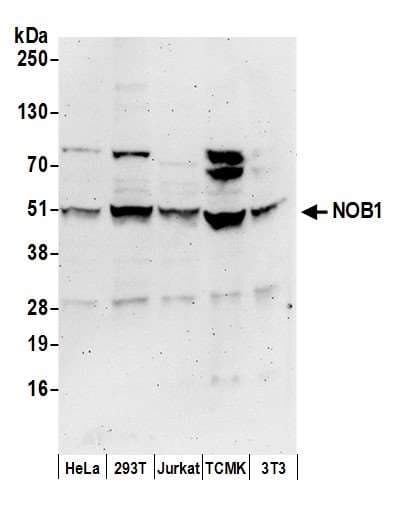 Polyclonal Rabbit anti-Human NOB1 / NOB1P Antibody (aa362-412, WB)