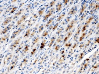 Polyclonal Rabbit anti-Human CCT2 / CCT Beta Antibody (IHC, WB)