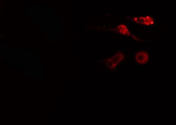 NCAPH / CAP-H Antibody
