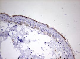 KLK8 / Kallikrein 8 Antibody (aa33-260, clone OTI11C3)