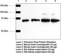 IHC-plus™ SPTLC2 / LCB2 Antibody (aa548-562)