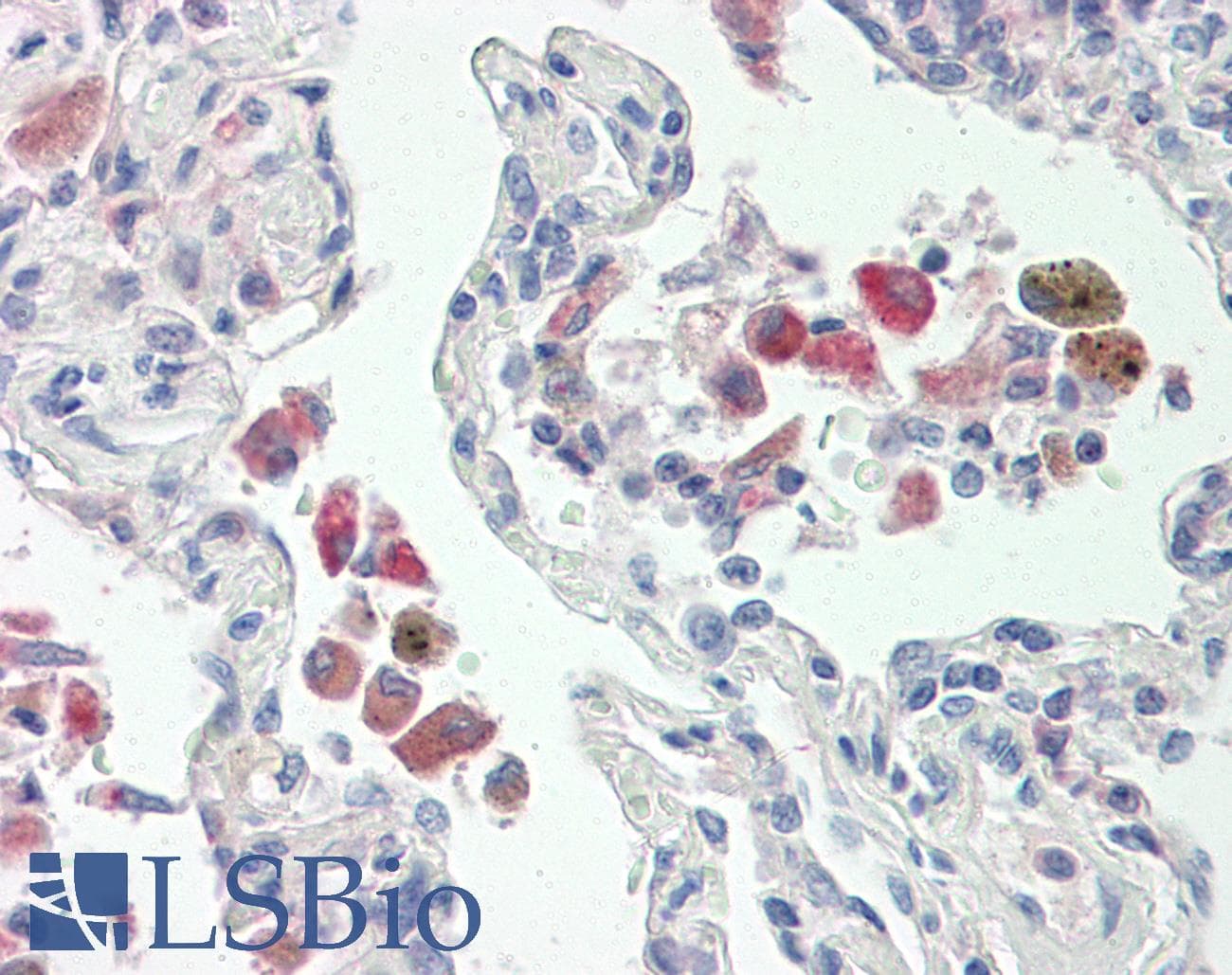 IHC-plus™ WASF2 / SCAR2 Antibody (aa190-239)