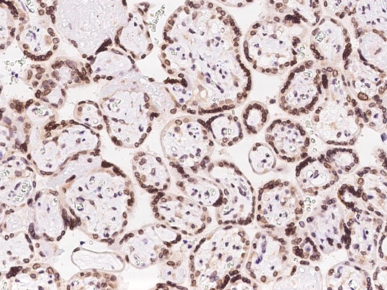 NUP62 Antibody