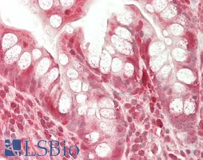 IHC-plus™ ENTPD5 / CD39L4 Antibody