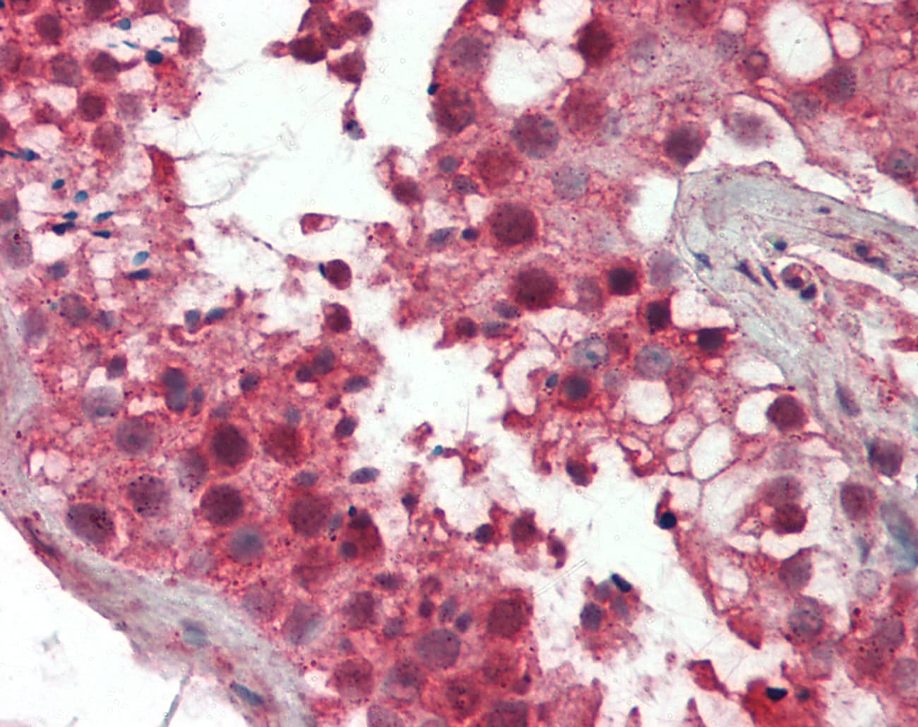 Polyclonal Rabbit anti-Human FUNDC2 Antibody (aa24-73, IHC, WB)