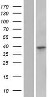 C16orf91 Protein (Over-Expression Lysate Myc-DDK (Flag))
