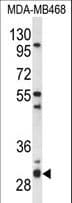 TNFSF5IP1 / CLAST3 Antibody (aa217-246)