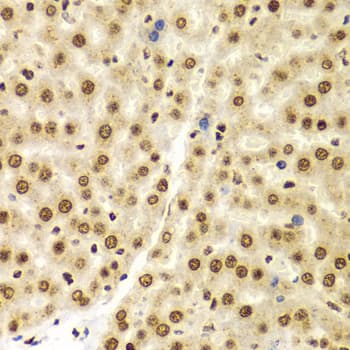 Polyclonal Rabbit anti-Human Histone H3 Antibody (IHC, IF, WB)