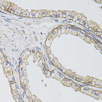 IHC-plus™ SLC1A4 / ASCT1 Antibody